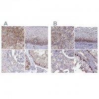 Anti-HSP90AB1 antibody produced in rabbit 
