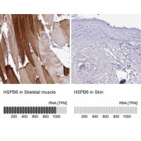 Anti-HSPB6 antibody produced in rabbit 