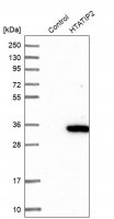 Anti-HTATIP2 antibody produced in rabbit HPA006417-100UL