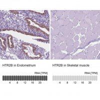 Anti-HTR2B antibody produced in rabbit 