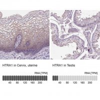Anti-HTRA1 antibody produced in rabbit 