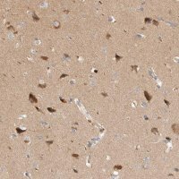 Anti-HTT antibody produced in rabbit 
