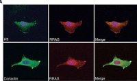 Anti-Huntingtin (N-terminal) antibody produced in rabbit 