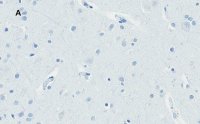 Anti-Huntingtin Protein Antibody, clone 1M11, ZooMAb� Rabbit Monoclonal 
