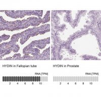 Anti-HYDIN antibody produced in rabbit