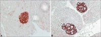 Anti-IAPP (N-terminal) antibody produced in rabbit SAB4200494-200UL