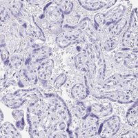 Anti-IAPP antibody produced in rabbit 