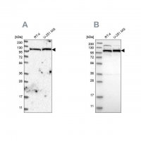 Anti-IARS2 antibody produced in rabbit HPA024596-100UL
