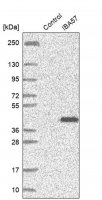 Anti-IBA57 antibody produced in rabbit HPA030557-100UL