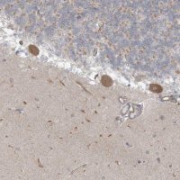 Anti-ICMT antibody produced in rabbit 