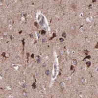 Anti-IDH3G antibody produced in rabbit 