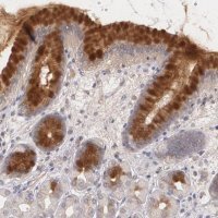 Anti-IFNGR2 antibody produced in rabbit