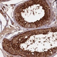 Anti-IFT22 antibody produced in rabbit 