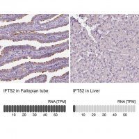 Anti-IFT52 antibody produced in rabbit 