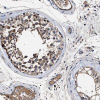 Anti-IFT81 antibody produced in rabbit