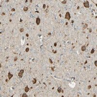 Anti-IGDCC4 antibody produced in rabbit 