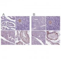 Anti-IGF2BP1 antibody produced in rabbit 