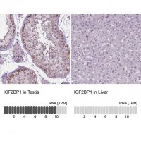 Anti-IGF2BP1 antibody produced in rabbit 