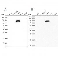 Anti-IGFALS antibody produced in rabbit 