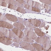 Anti-IGFN1 antibody produced in rabbit