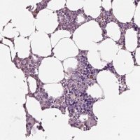 Anti-IGLL1 antibody produced in rabbit