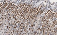 Anti-IKB Antibody, clone 6O8, ZooMAb� Rabbit Monoclonal 