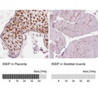 Anti-IKBIP antibody produced in rabbit 