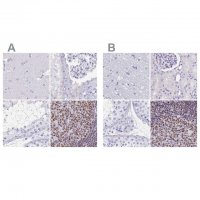 Anti-IKZF1 antibody produced in rabbit 