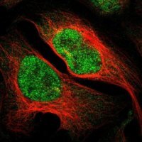 Anti-IKZF5 antibody produced in rabbit 