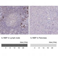 Anti-IL18BP antibody produced in rabbit