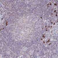 Anti-IL18BP antibody produced in rabbit