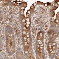 Anti-IL1R2 antibody produced in rabbit