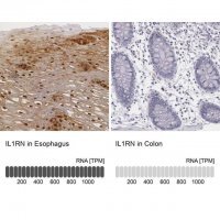 Anti-IL1RN antibody produced in rabbit