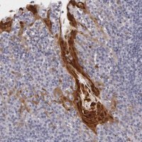Anti-IL1RN antibody produced in rabbit