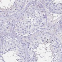 Anti-IL2RA antibody produced in rabbit 