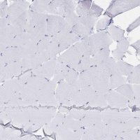 Anti-IL2RB antibody produced in rabbit