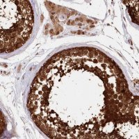 Anti-IMPA1 antibody produced in rabbit