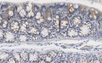 Anti-iNOS (NOSII) Antibody, clone 2G17 ZooMAb� Rabbit Monoclonal 