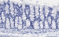 Anti-iNOS (NOSII) Antibody, clone 2G17 ZooMAb® Rabbit Monoclonal