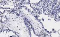 Anti-Integrin -5 Antibody, clone 5E18 ZooMAb� Rabbit Monoclonal 