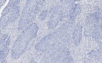 Anti-Integrin 1 Antibody, clone 1A27 , ZooMAb� Rabbit Monoclonal 