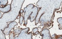 Anti-Integrin 3 Antibody, clone EM00212 ZooMAb� Rabbit Monoclonal 