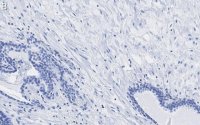 Anti-Integrin beta 1 Antibody, clone HUTS-4 ZooMAb� Mouse Monoclonal 