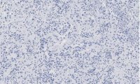 Anti-Integrin pan-V Antibody, clone EM01309 , ZooMAb� Rabbit Monoclonal 