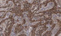 Anti-Integrin pan-V Antibody, clone EM01309 , ZooMAb� Rabbit Monoclonal 