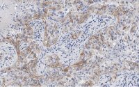Anti-Integrin V3 Antibody, clone EM22703 ZooMAb� Rabbit Monoclonal 