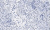 Anti-Integrin V5 Antibody, clone EM09902 , ZooMAb� Rabbit Monoclonal 
