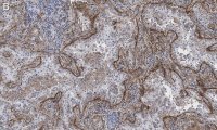 Anti-Integrin V5 Antibody, clone EM09902 , ZooMAb� Rabbit Monoclonal 