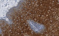 Anti-Involucrin Antibody, clone 1D13 ZooMAb� Rabbit Monoclonal 