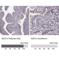 Anti-IQCG 